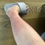 The No-Sew Hole Fixing Guide: Mend Your Clothes Without Having to Use Stitches!